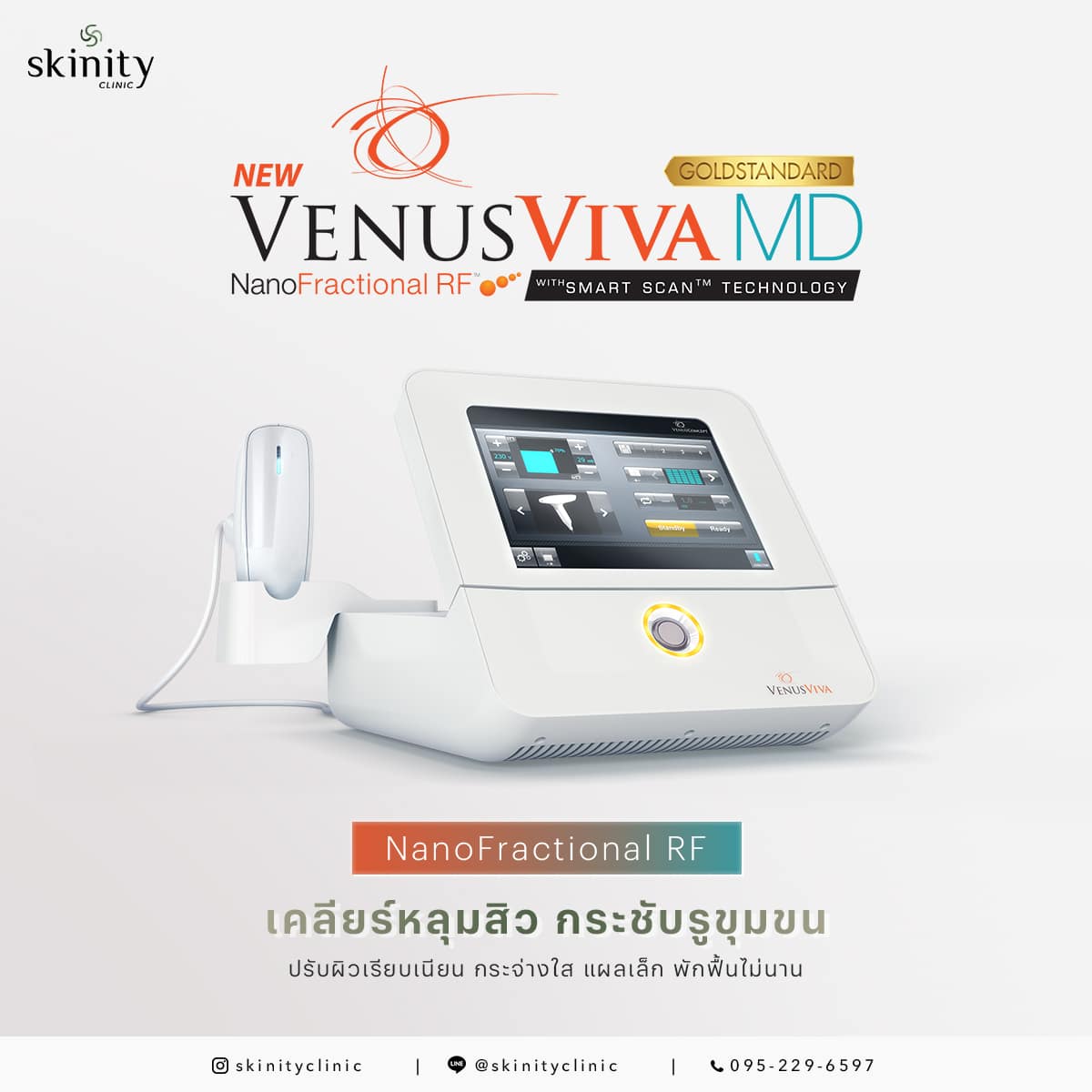 venus-viva-md-skinity-clinic