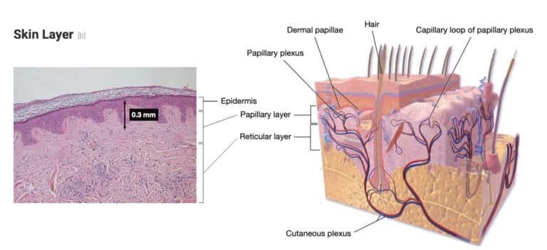 แบบจำลองความลึกของชั้นผิวเมื่อรักษาด้วย Sylfirm X Plus