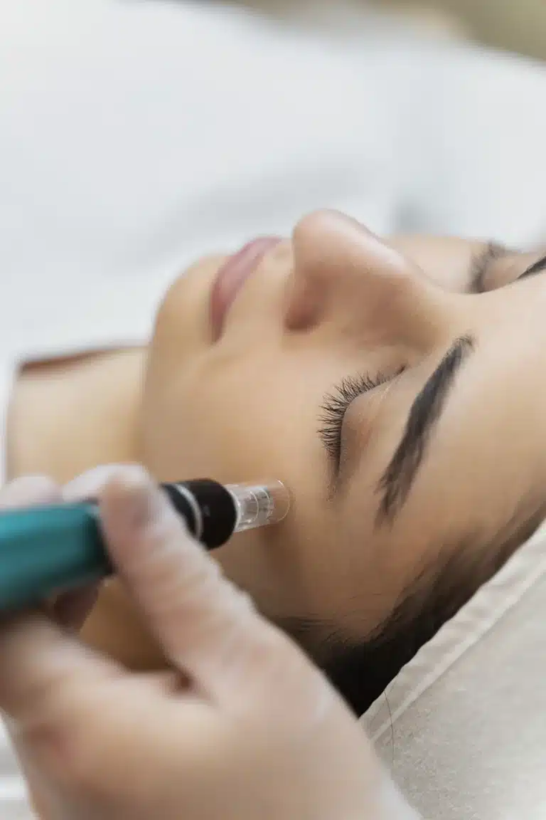 Comparing Microneedling and RF Microneedling: Which Treatment is Right for You?