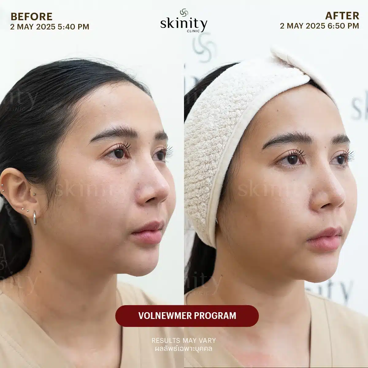 รีวิว Volnewmer