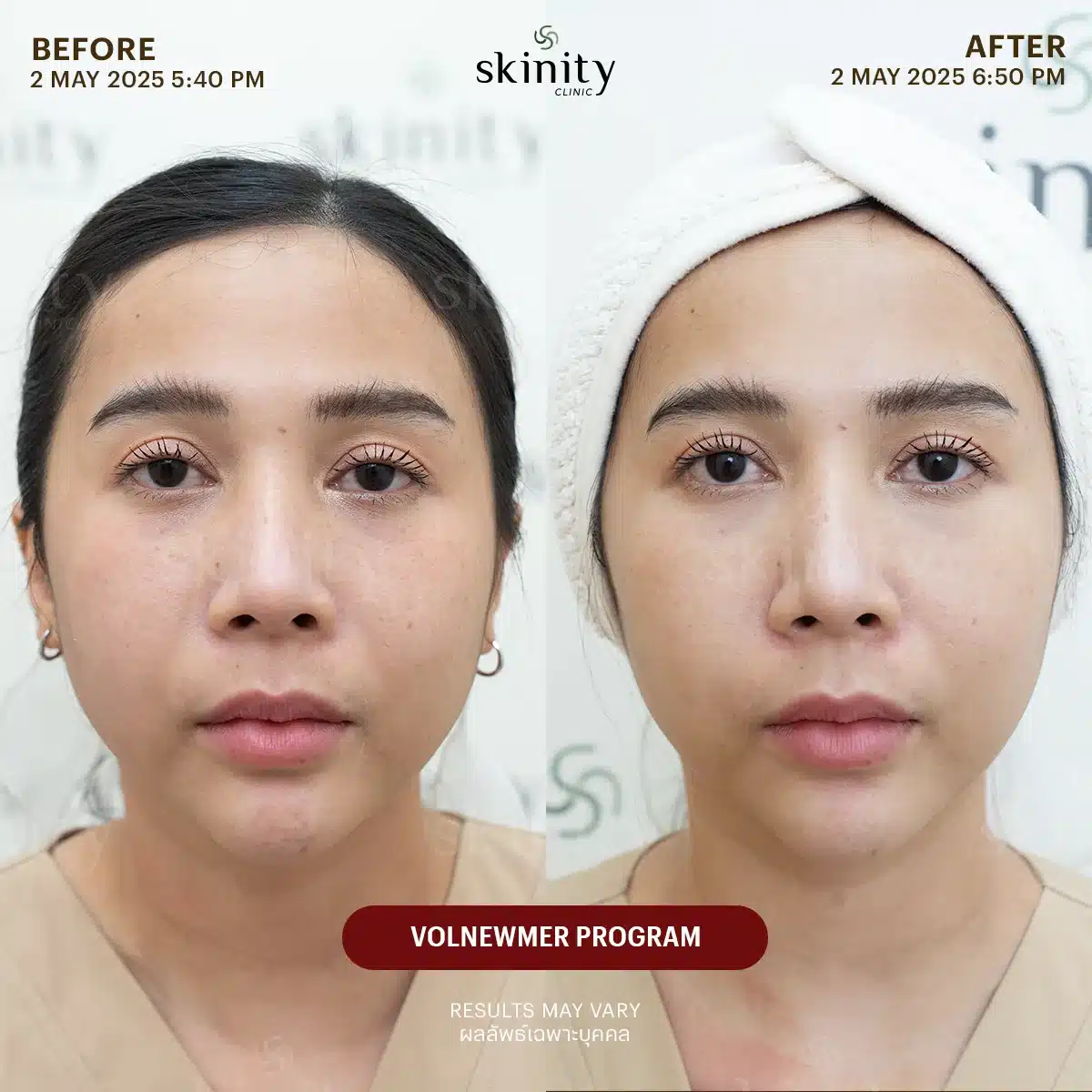 รีวิว Volnewmer