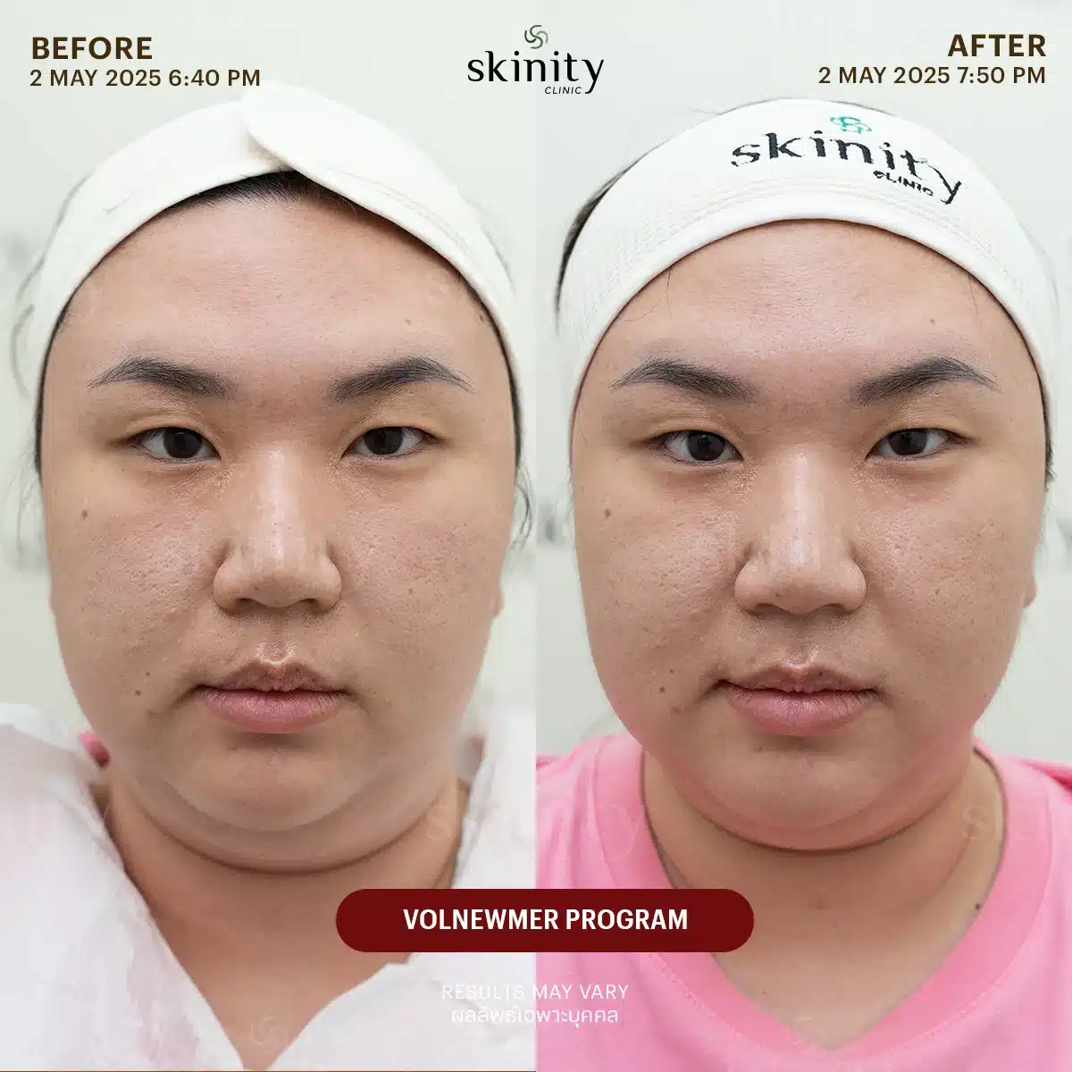 รีวิว Volnewmer